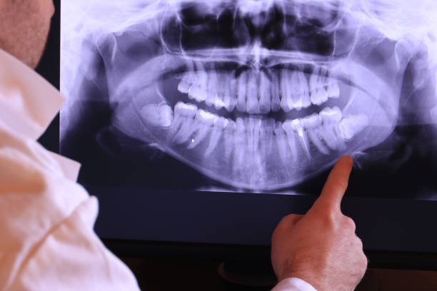 Best Emergency Root Canal Treatment in Echelon, NJ