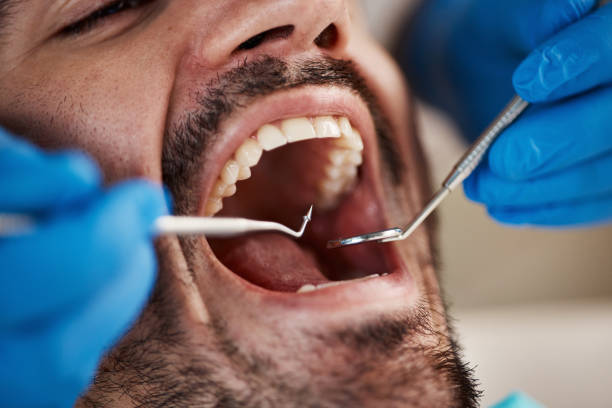 Best After-Hours Emergency Dentist in Echelon, NJ